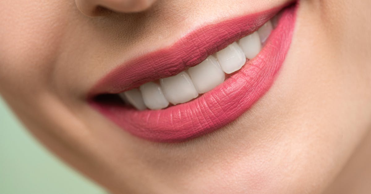 Is gum reshaping expensive?