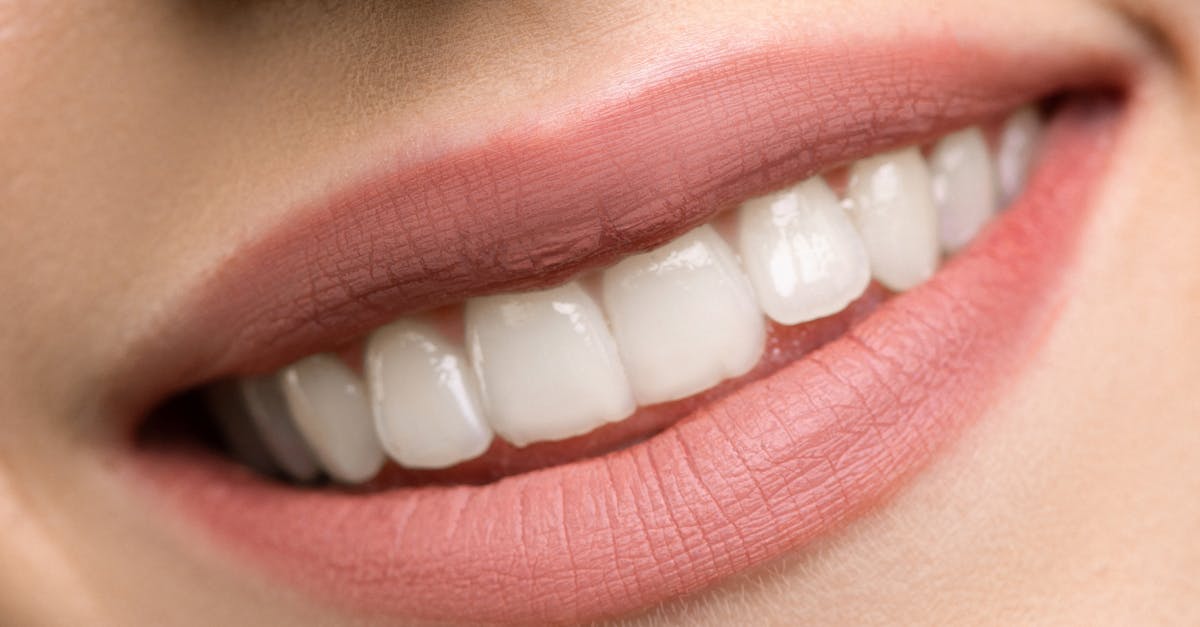 What are the benefits of crowns and bridges?
